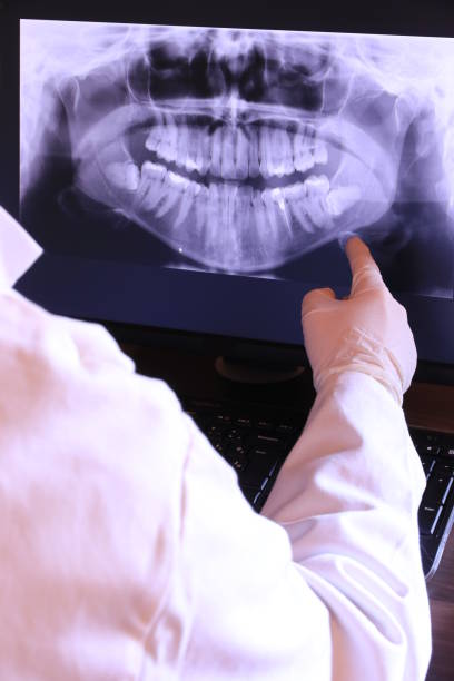 Best Emergency Treatment for Dental Infections or Abscesses in Phillipsburg, NJ